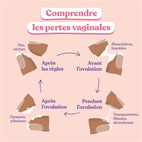 perte blanche infection|Pertes vaginales : en savoir plus sur les leucorrhées